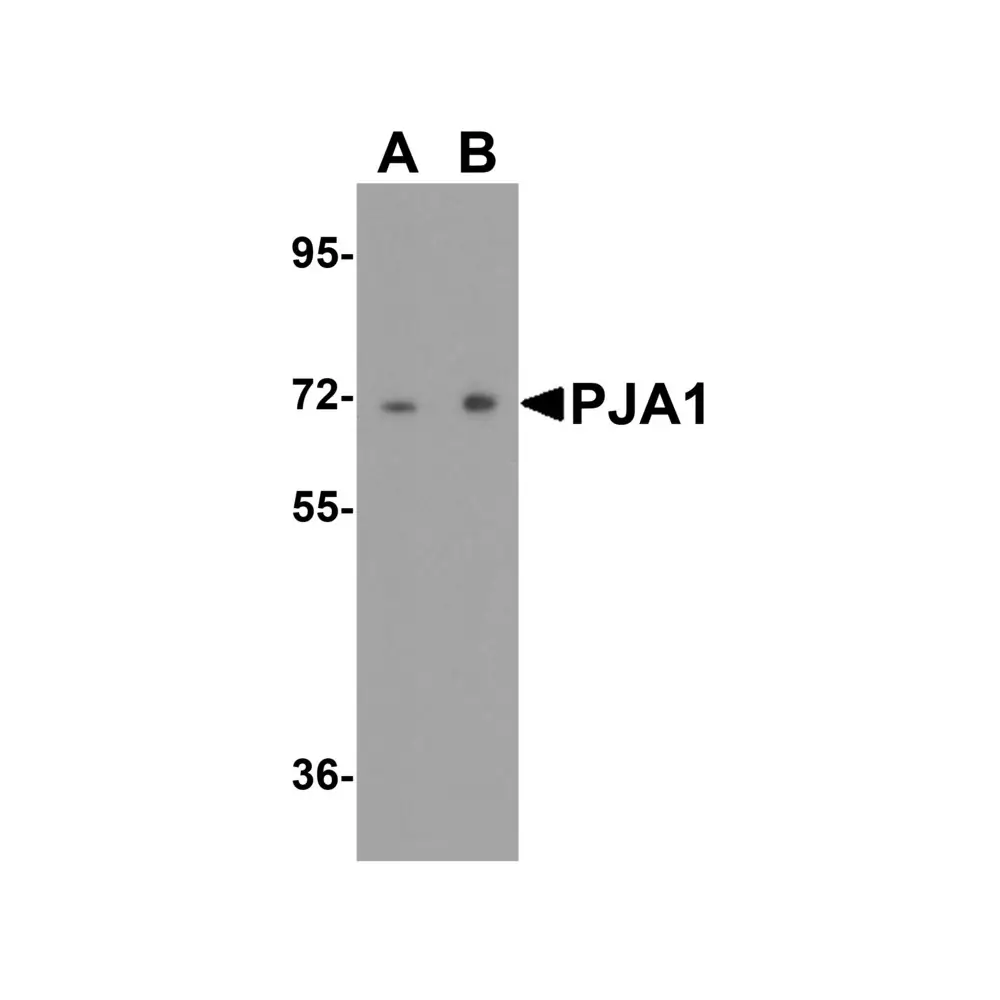 ProSci 8069 PJA1 Antibody, ProSci, 0.1 mg/Unit Primary Image