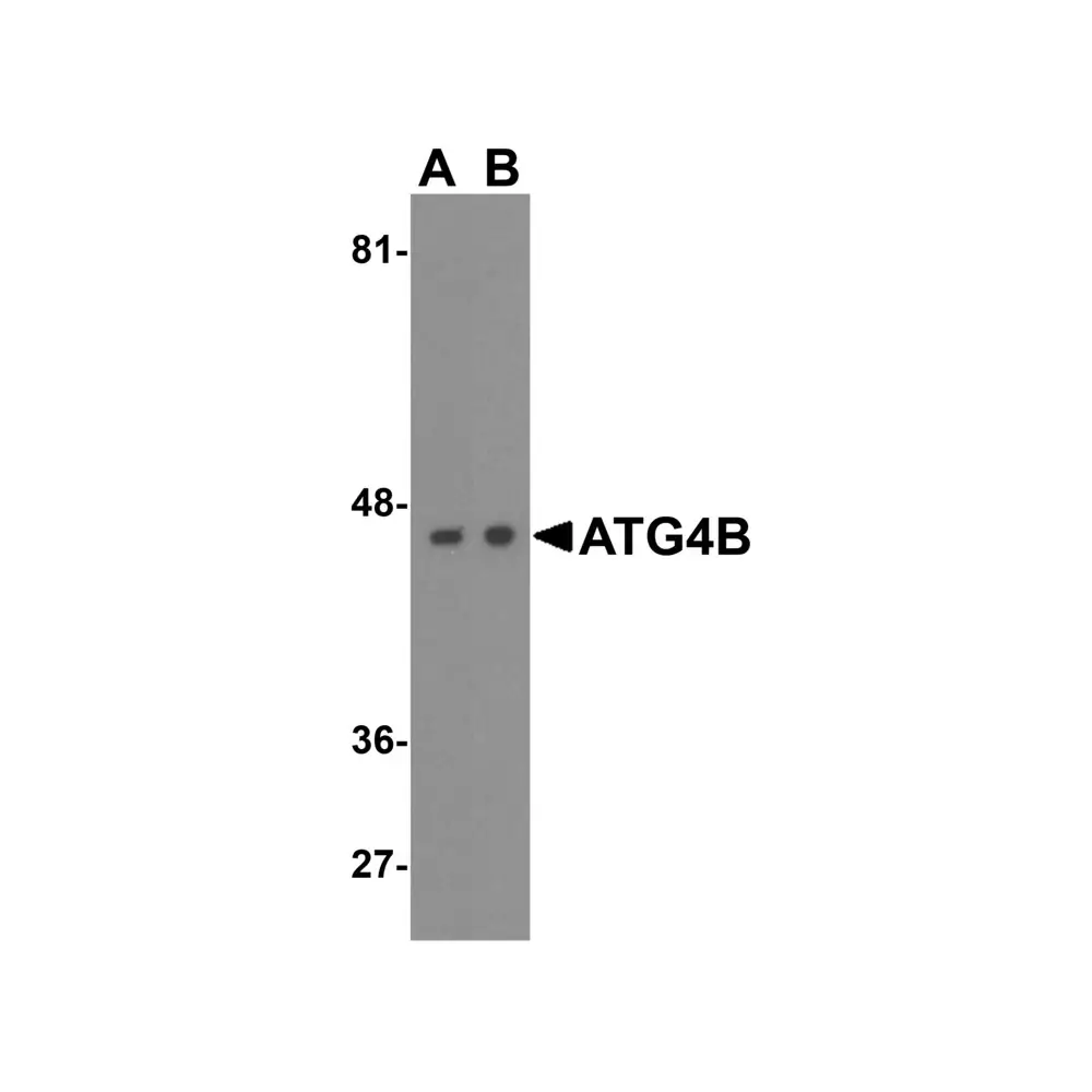 ProSci 8073_S ATG4B Antibody, ProSci, 0.02 mg/Unit Primary Image