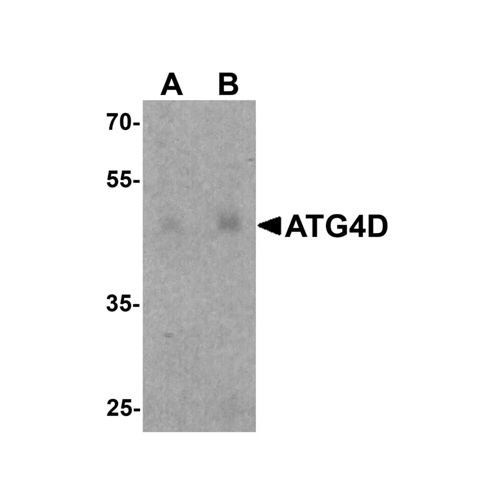 ProSci 8075_S ATG4D Antibody, ProSci, 0.02 mg/Unit Primary Image
