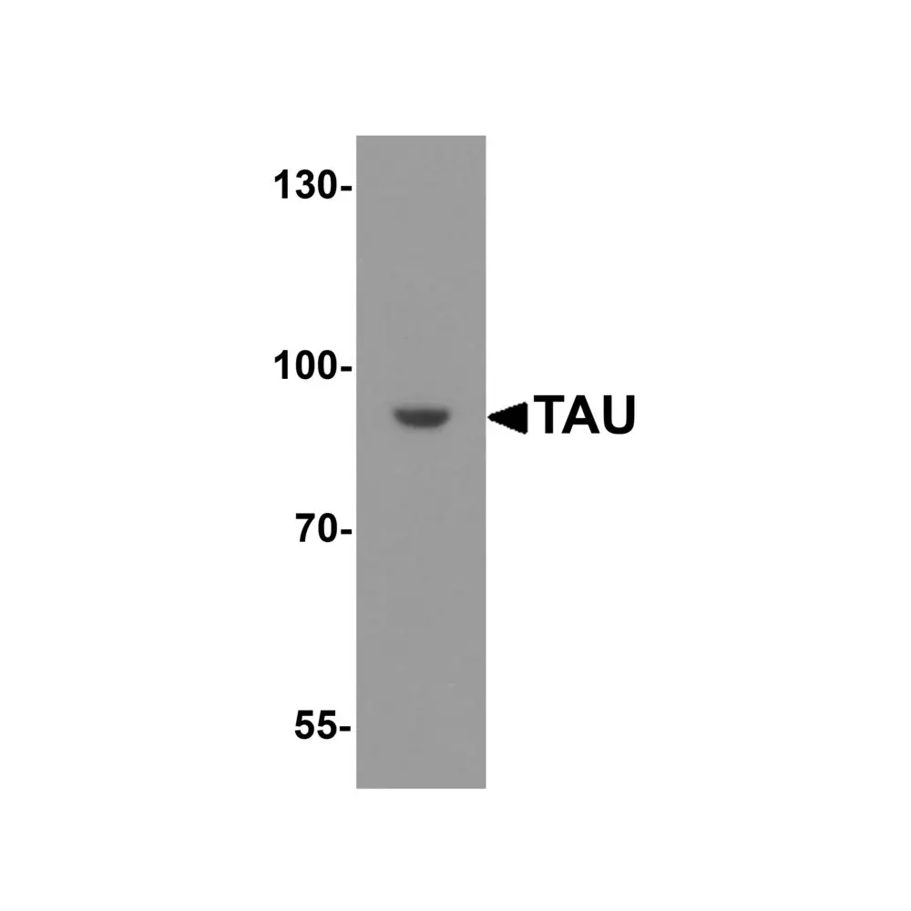 ProSci 8077 TAU Antibody, ProSci, 0.1 mg/Unit Primary Image