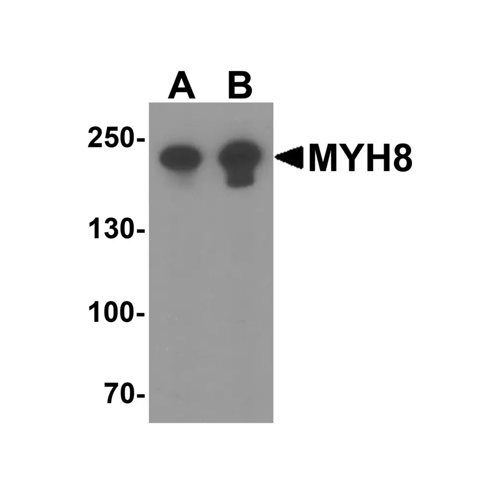 ProSci 8081_S MYH8 Antibody, ProSci, 0.02 mg/Unit Primary Image