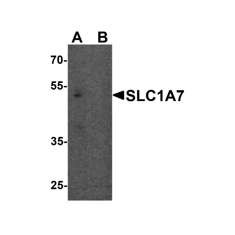 ProSci 8083 SLC1A7 Antibody, ProSci, 0.1 mg/Unit Primary Image