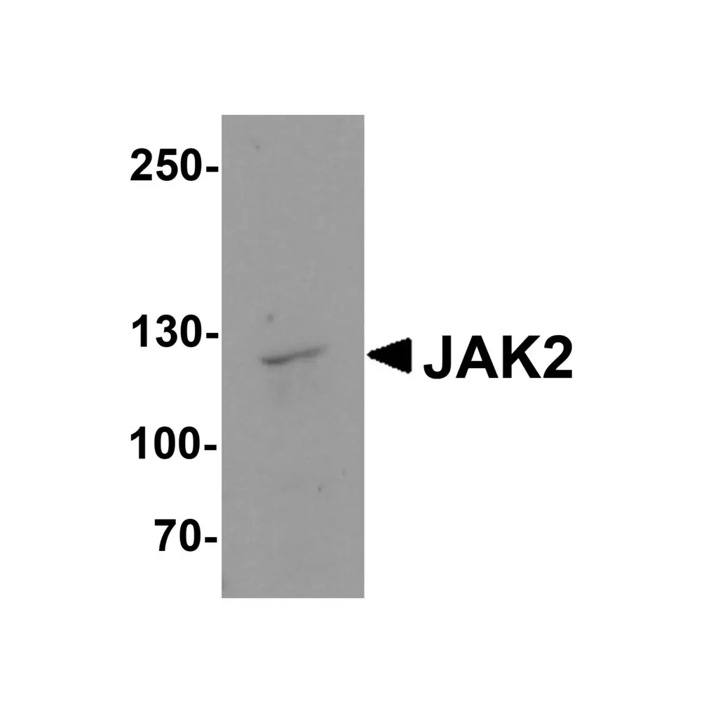 ProSci 8085 JAK2 Antibody, ProSci, 0.1 mg/Unit Primary Image