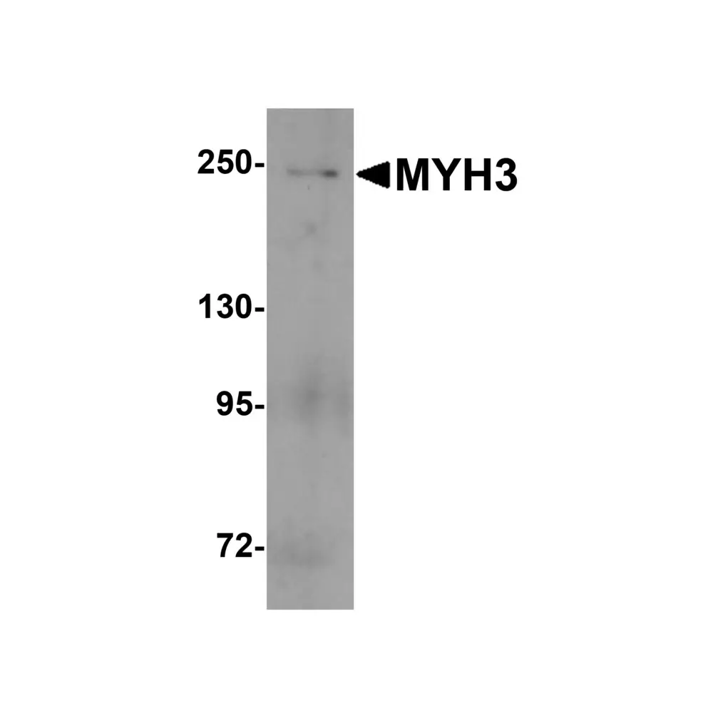ProSci 8087_S MYH3 Antibody, ProSci, 0.02 mg/Unit Primary Image