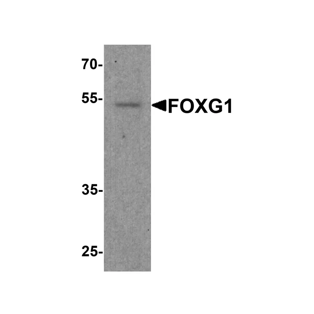 ProSci 8089_S FOXG1 Antibody, ProSci, 0.02 mg/Unit Primary Image