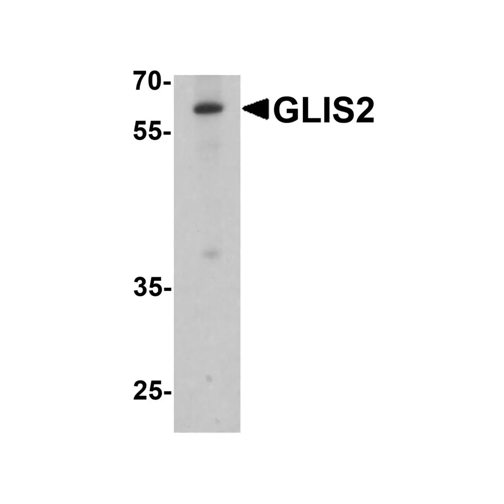 ProSci 8091 GLIS2 Antibody, ProSci, 0.1 mg/Unit Primary Image