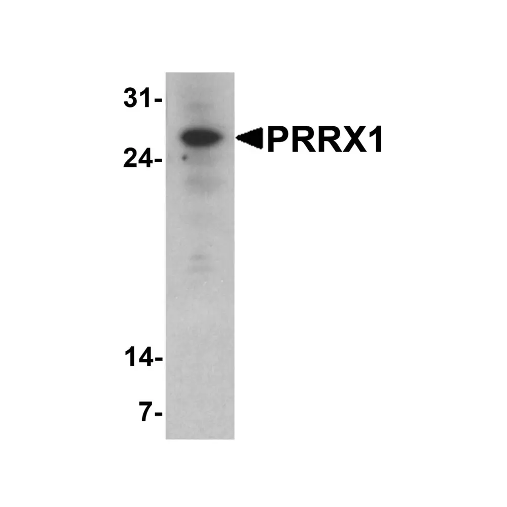 ProSci 8093 PRRX1 Antibody, ProSci, 0.1 mg/Unit Primary Image
