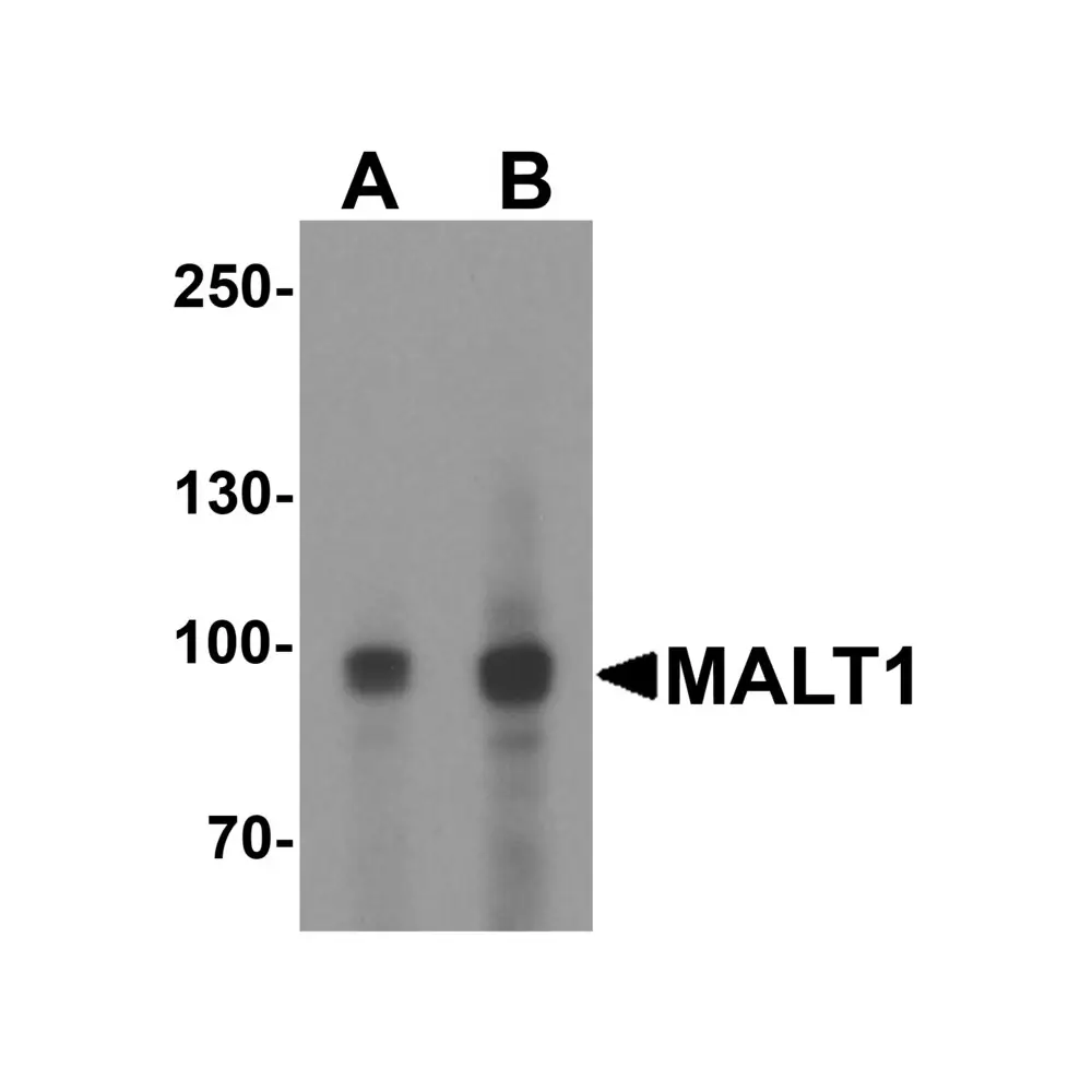 ProSci 8097_S MALT1 Antibody, ProSci, 0.02 mg/Unit Primary Image