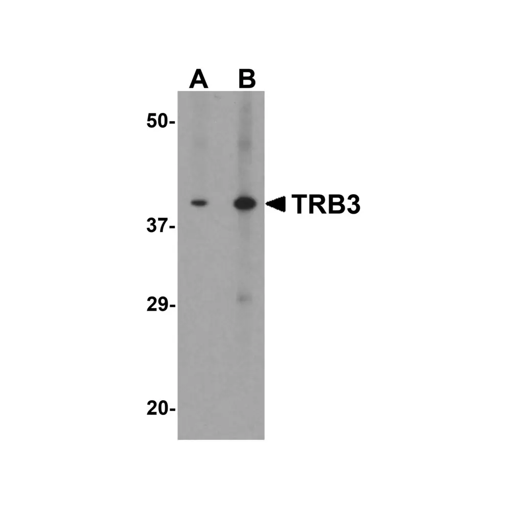 ProSci 8099 TRB3 Antibody, ProSci, 0.1 mg/Unit Primary Image
