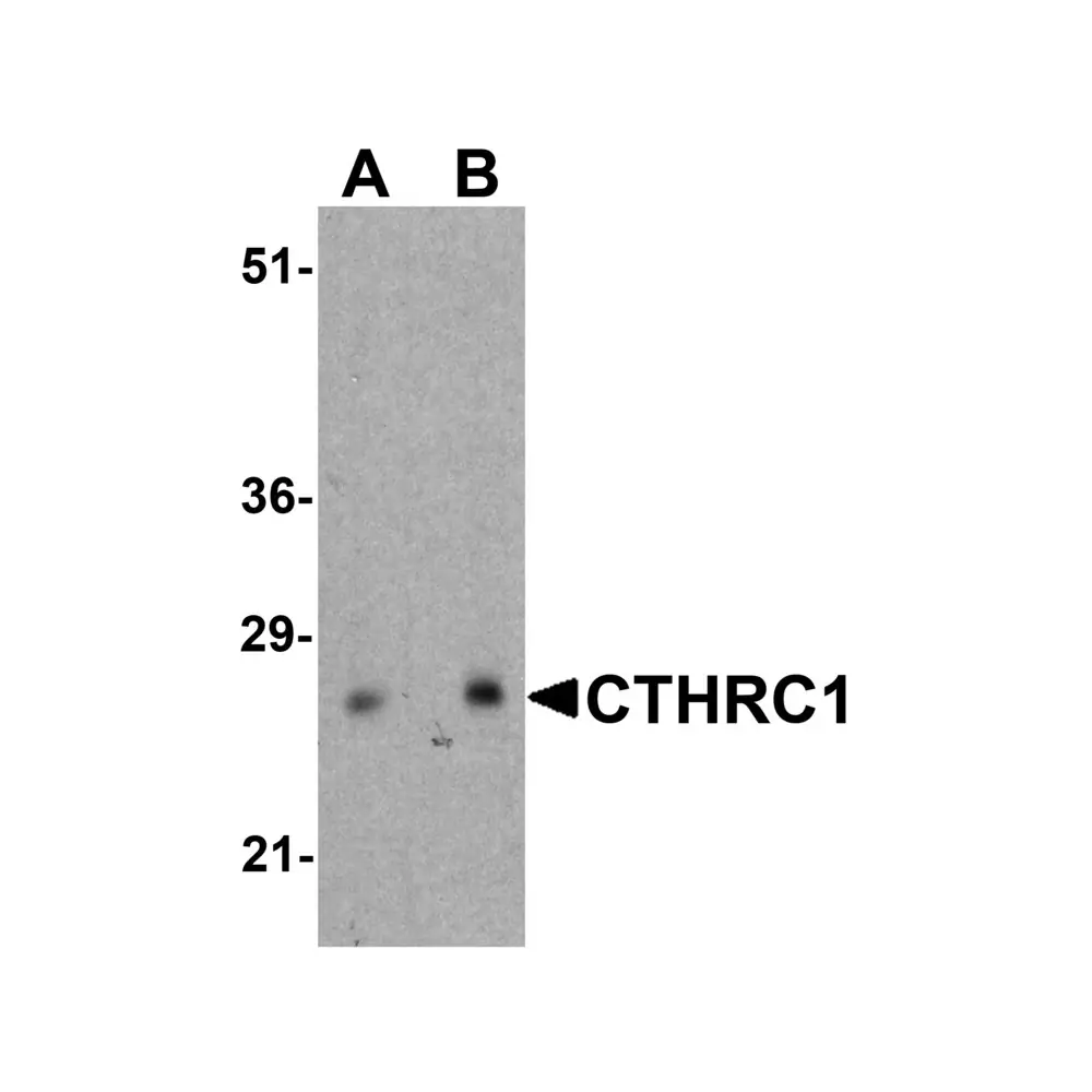 ProSci 8101_S CTHRC1 Antibody, ProSci, 0.02 mg/Unit Primary Image