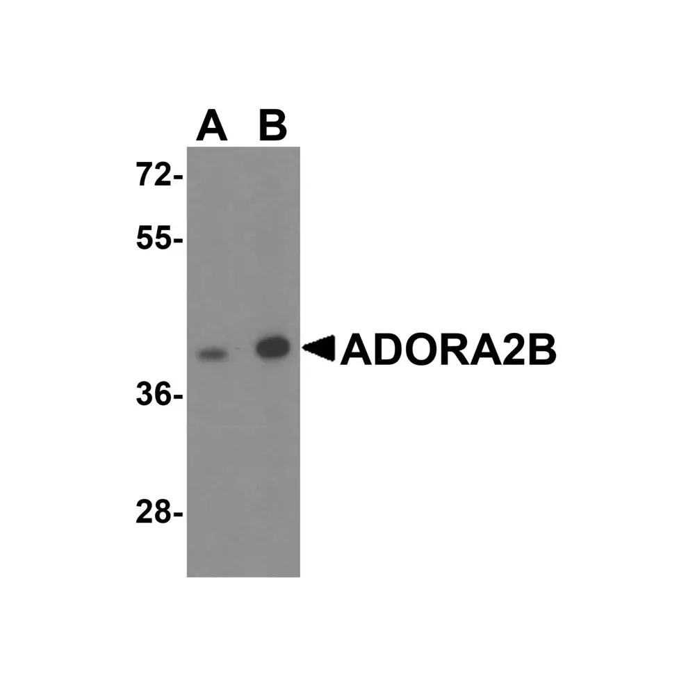 ProSci 8111 ADORA2B Antibody, ProSci, 0.1 mg/Unit Primary Image