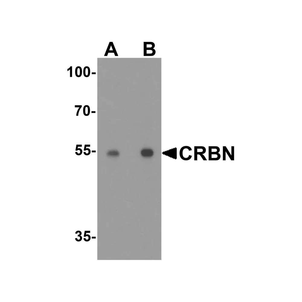 ProSci 8115 CRBN Antibody, ProSci, 0.1 mg/Unit Primary Image