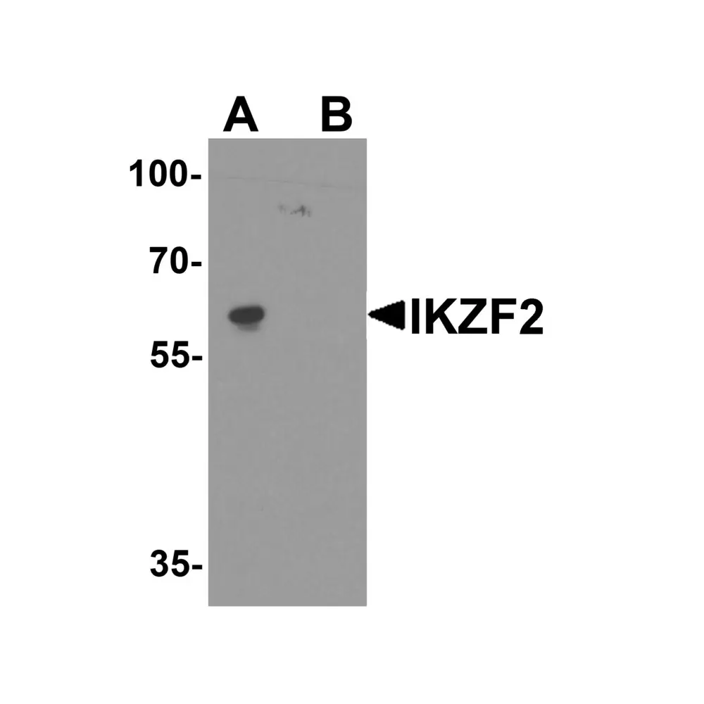 ProSci 8117 IKZF2 Antibody, ProSci, 0.1 mg/Unit Primary Image
