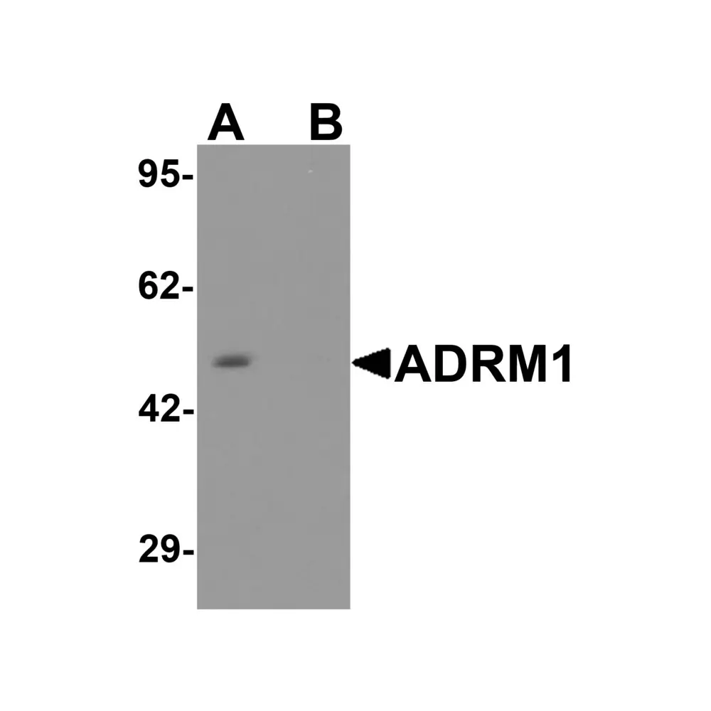 ProSci 8119 ADRM1 Antibody, ProSci, 0.1 mg/Unit Primary Image