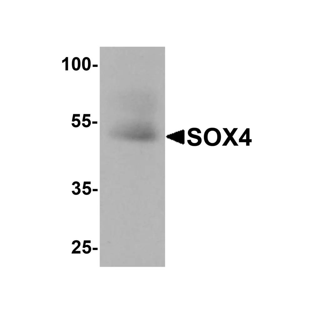 ProSci 8123 SOX4 Antibody, ProSci, 0.1 mg/Unit Primary Image