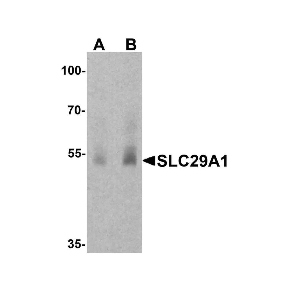 ProSci 8125 SLC29A1 Antibody, ProSci, 0.1 mg/Unit Primary Image