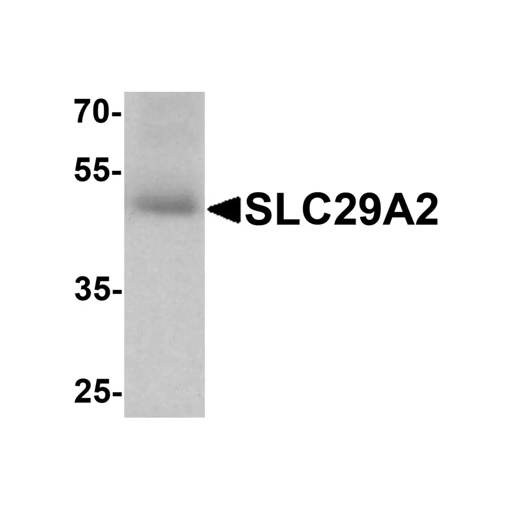 ProSci 8127 SLC29A2 Antibody, ProSci, 0.1 mg/Unit Primary Image
