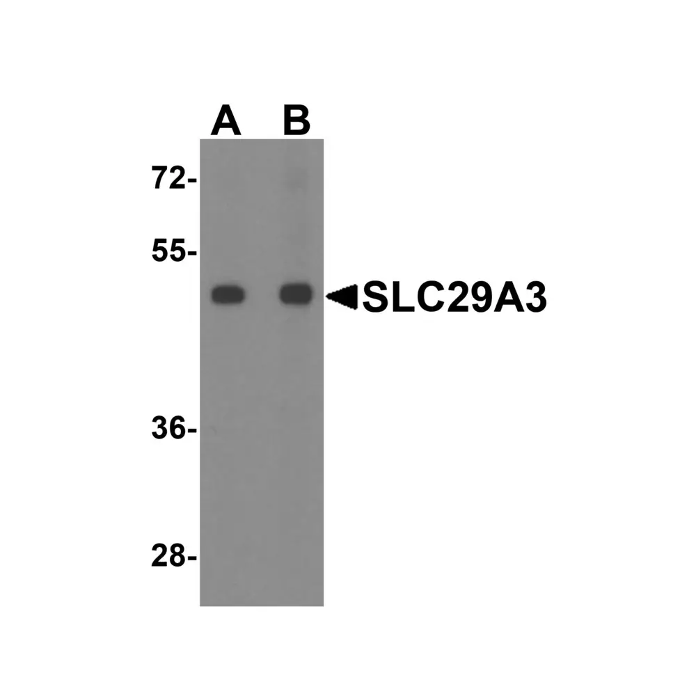 ProSci 8129 SLC29A3 Antibody, ProSci, 0.1 mg/Unit Primary Image