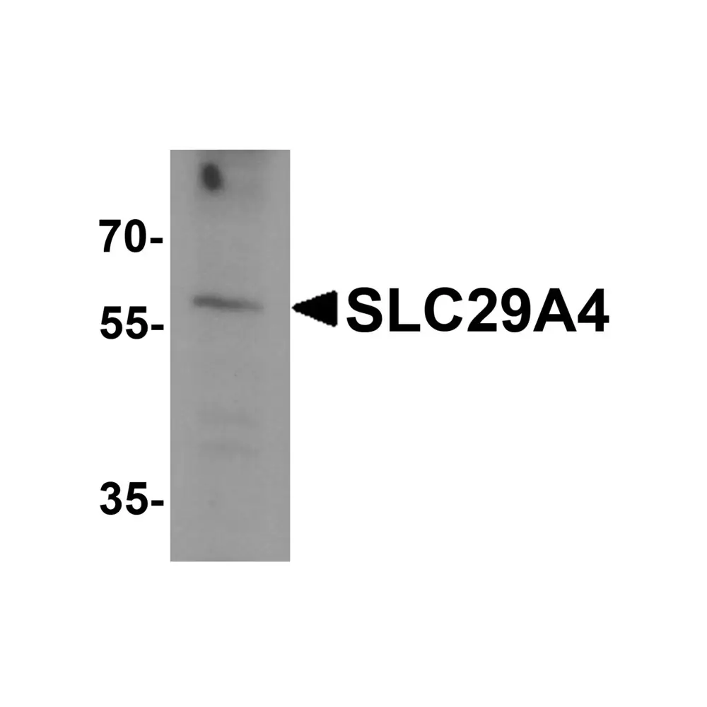 ProSci 8131 SLC29A4 Antibody, ProSci, 0.1 mg/Unit Primary Image
