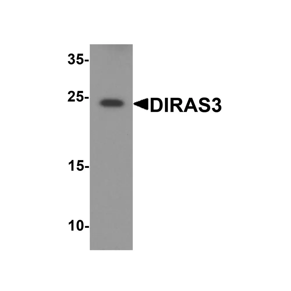 ProSci 8139 DIRAS3 Antibody, ProSci, 0.1 mg/Unit Primary Image