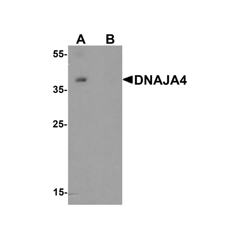 ProSci 8141_S DNAJA4 Antibody, ProSci, 0.02 mg/Unit Primary Image