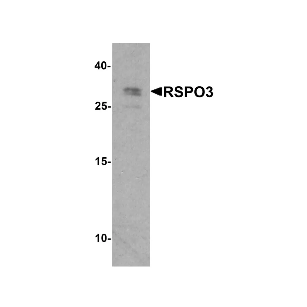ProSci 8153_S RSPO3 Antibody, ProSci, 0.02 mg/Unit Primary Image