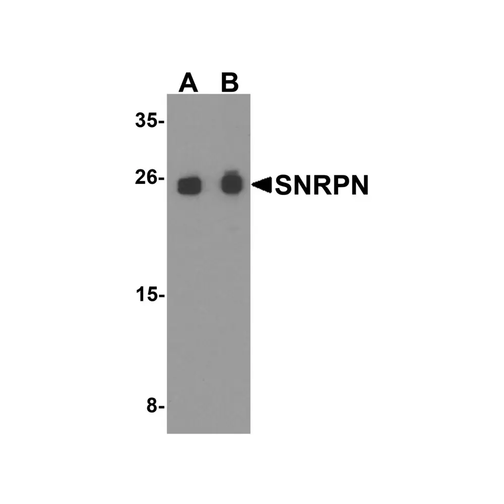 ProSci 8155_S SNRPN Antibody, ProSci, 0.02 mg/Unit Primary Image