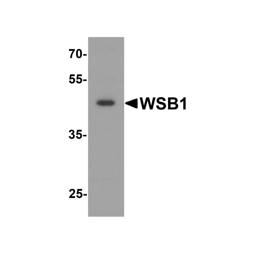 ProSci 8161 WSB1 Antibody, ProSci, 0.1 mg/Unit Primary Image