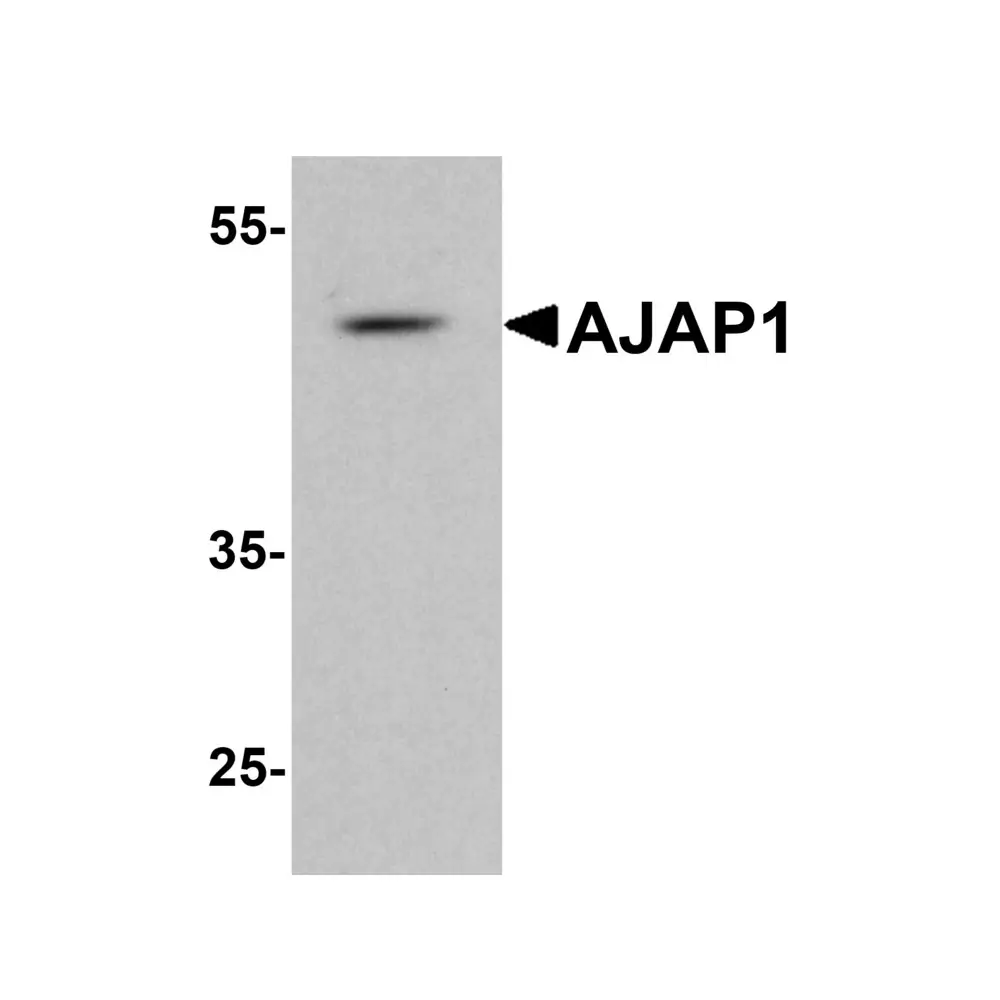 ProSci 8163 AJAP1 Antibody, ProSci, 0.1 mg/Unit Primary Image