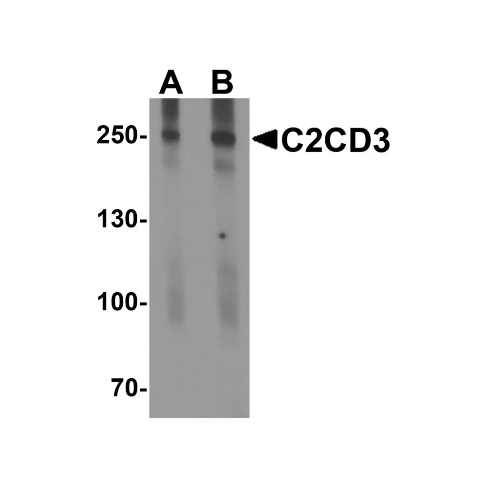 ProSci 8169 C2CD3 Antibody, ProSci, 0.1 mg/Unit Primary Image