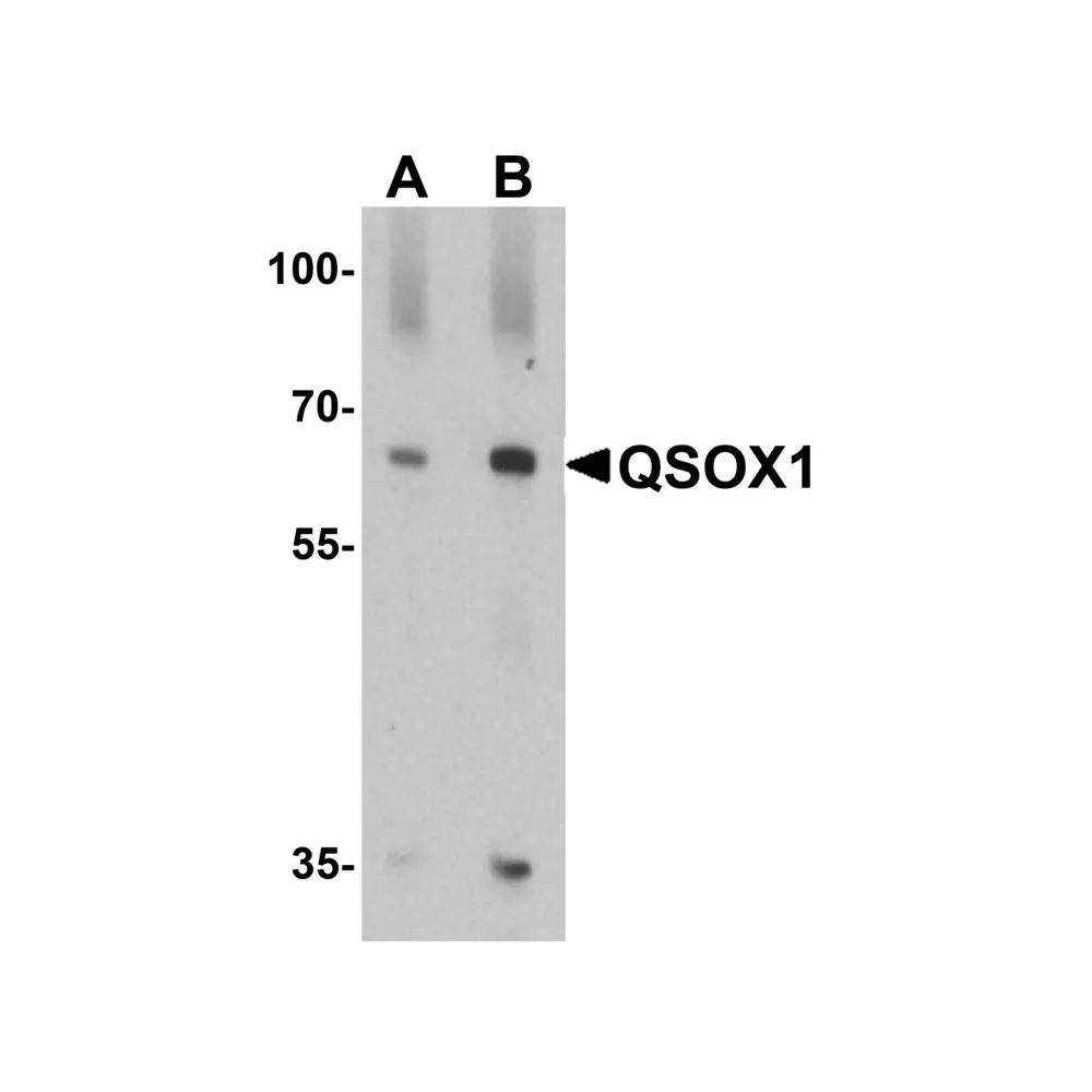 ProSci 8171_S QSOX1 Antibody, ProSci, 0.02 mg/Unit Primary Image