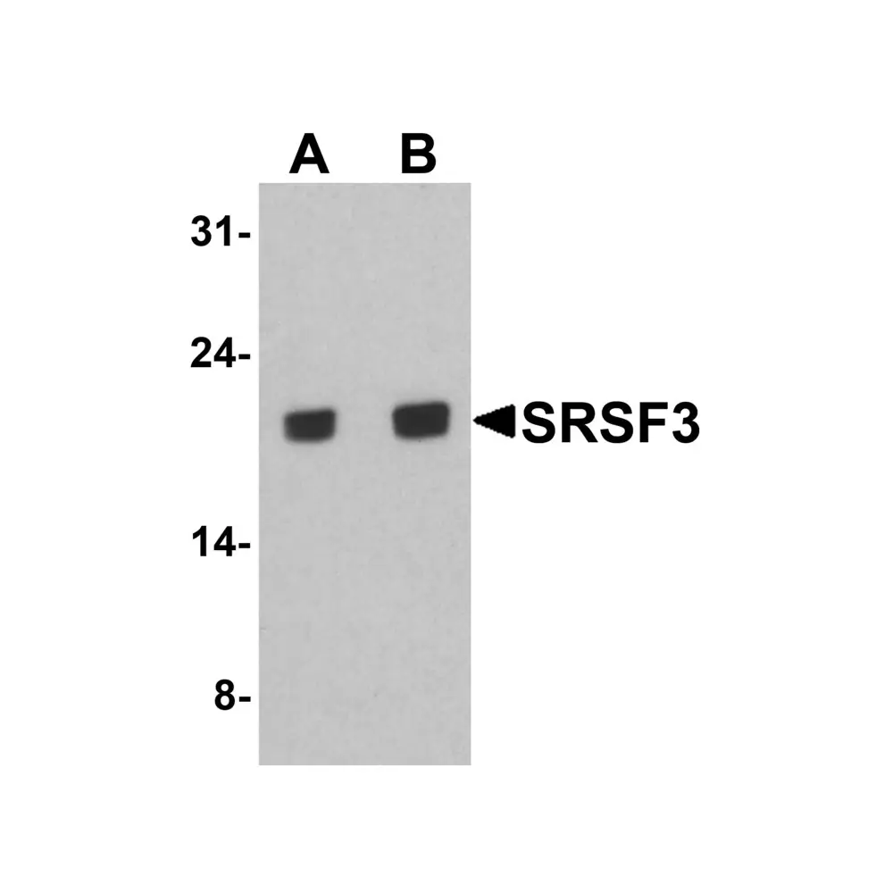 ProSci 8179 SRSF3 Antibody, ProSci, 0.1 mg/Unit Primary Image