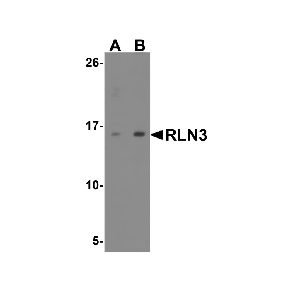 ProSci 8181 RLN3 Antibody, ProSci, 0.1 mg/Unit Primary Image