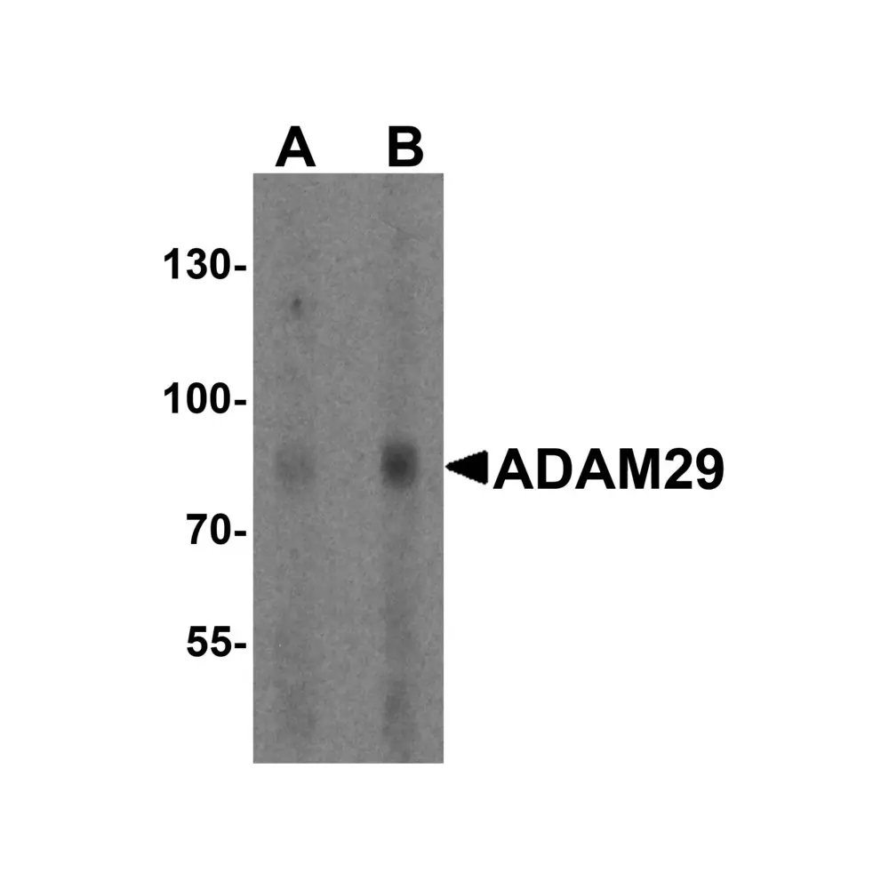 ProSci 8183 ADAM29 Antibody, ProSci, 0.1 mg/Unit Primary Image
