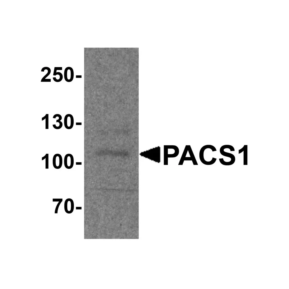 ProSci 8187_S PACS1 Antibody, ProSci, 0.02 mg/Unit Primary Image