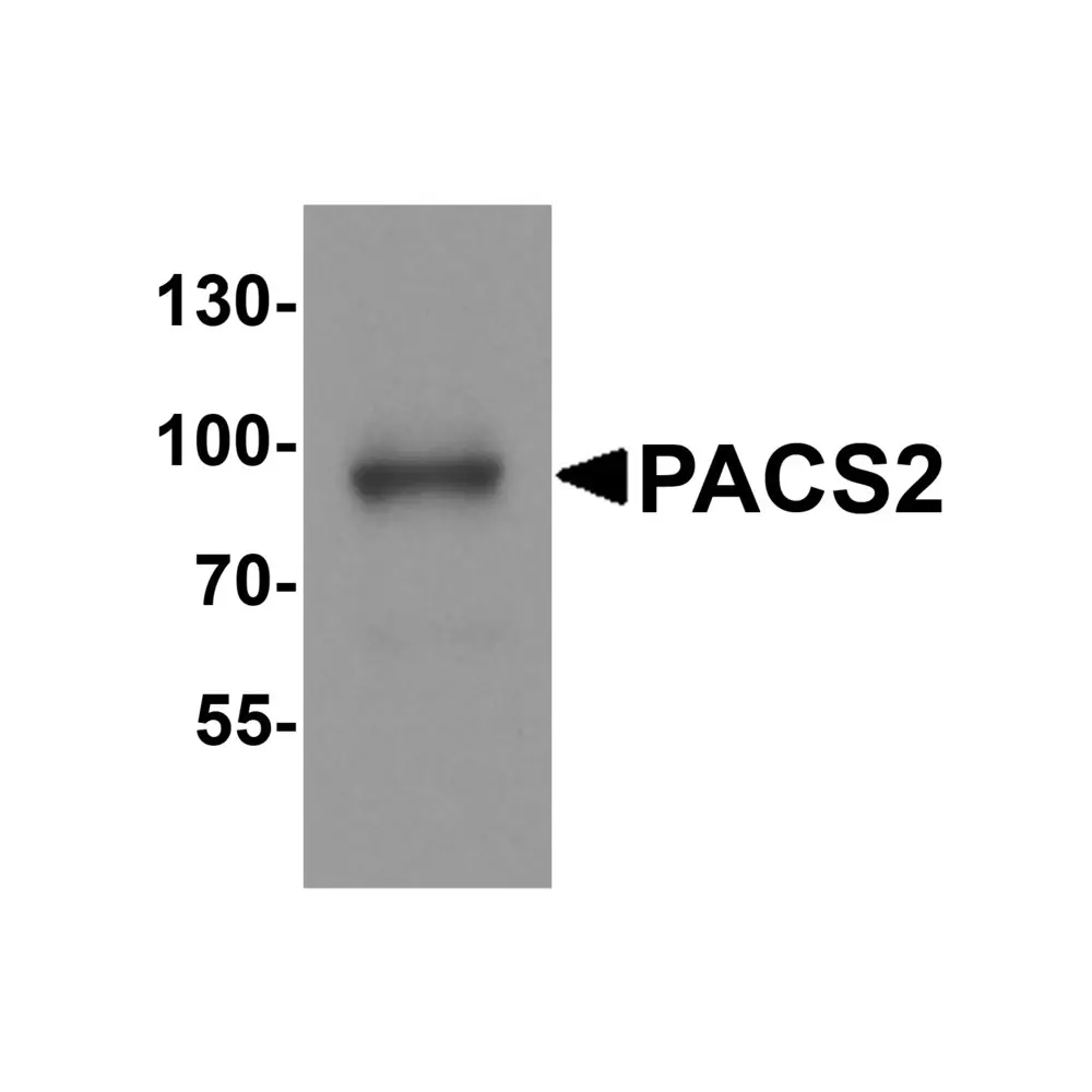 ProSci 8189_S PACS2 Antibody, ProSci, 0.02 mg/Unit Primary Image