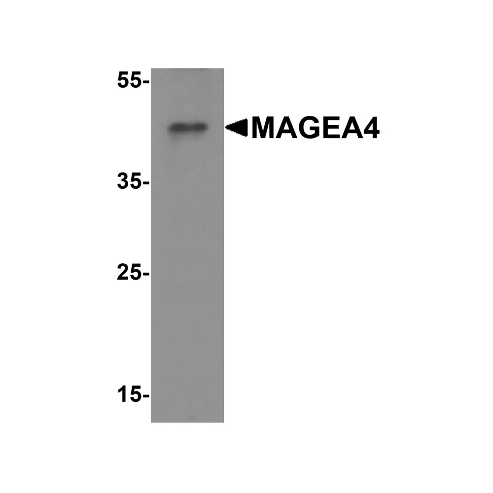 ProSci 8191 MAGEA4 Antibody, ProSci, 0.1 mg/Unit Primary Image