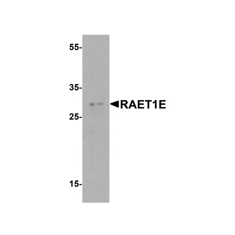 ProSci 8193 RAET1E Antibody, ProSci, 0.1 mg/Unit Primary Image