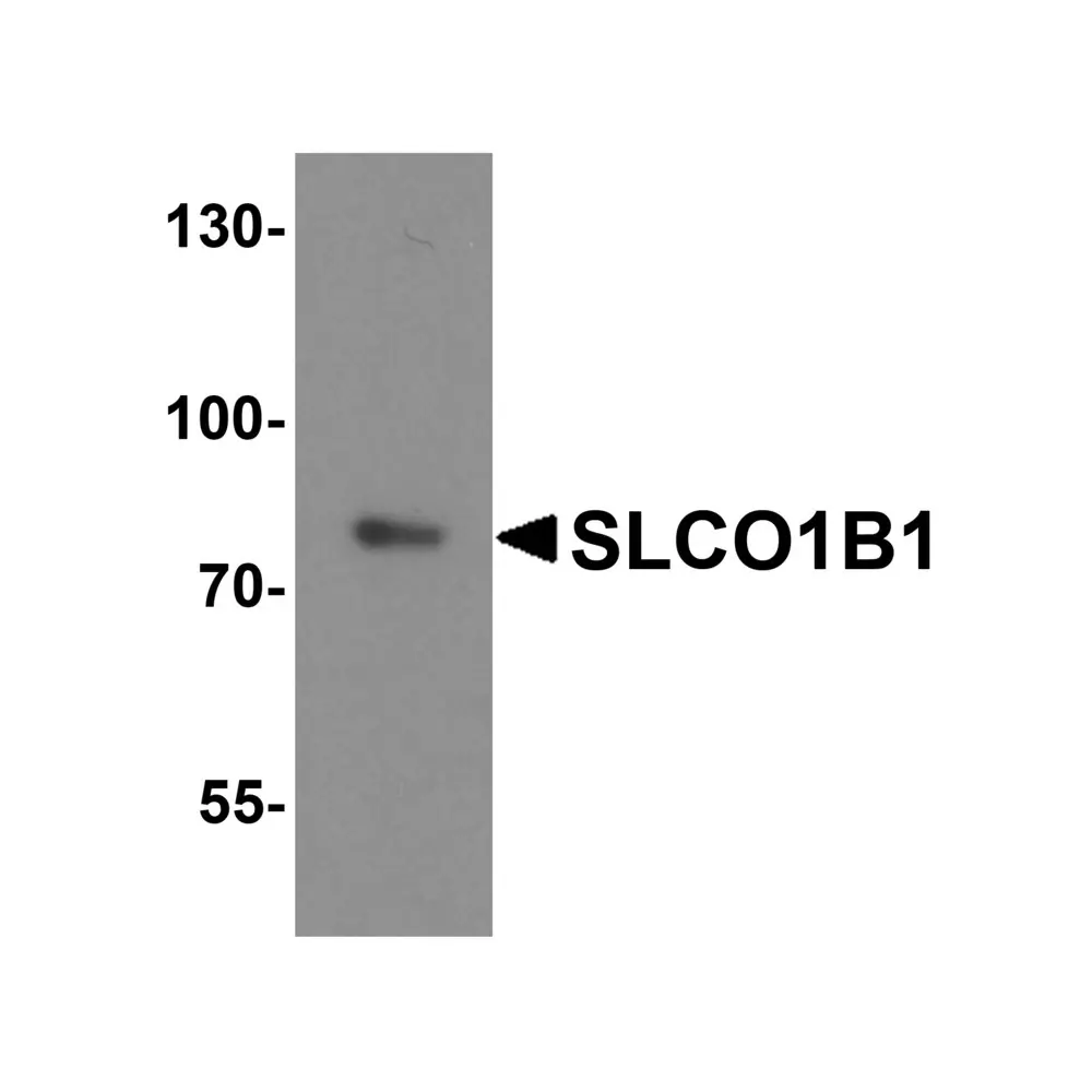 ProSci 8197_S SLCO1B1 Antibody, ProSci, 0.02 mg/Unit Primary Image