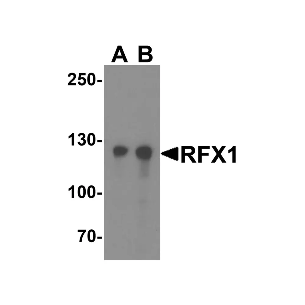 ProSci 8199 RFX1 Antibody, ProSci, 0.1 mg/Unit Primary Image