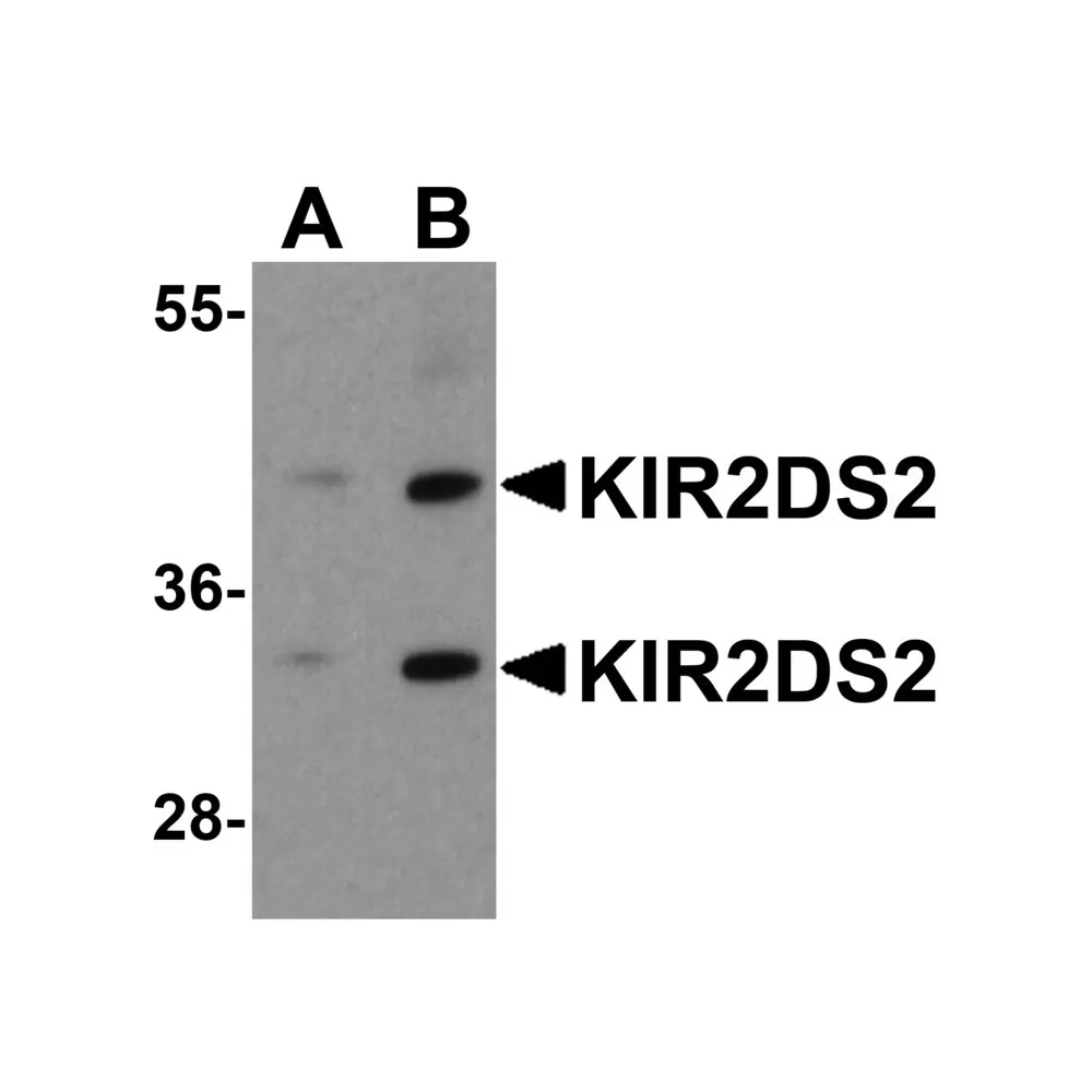 ProSci 8201 KIR2DS2 Antibody, ProSci, 0.1 mg/Unit Primary Image