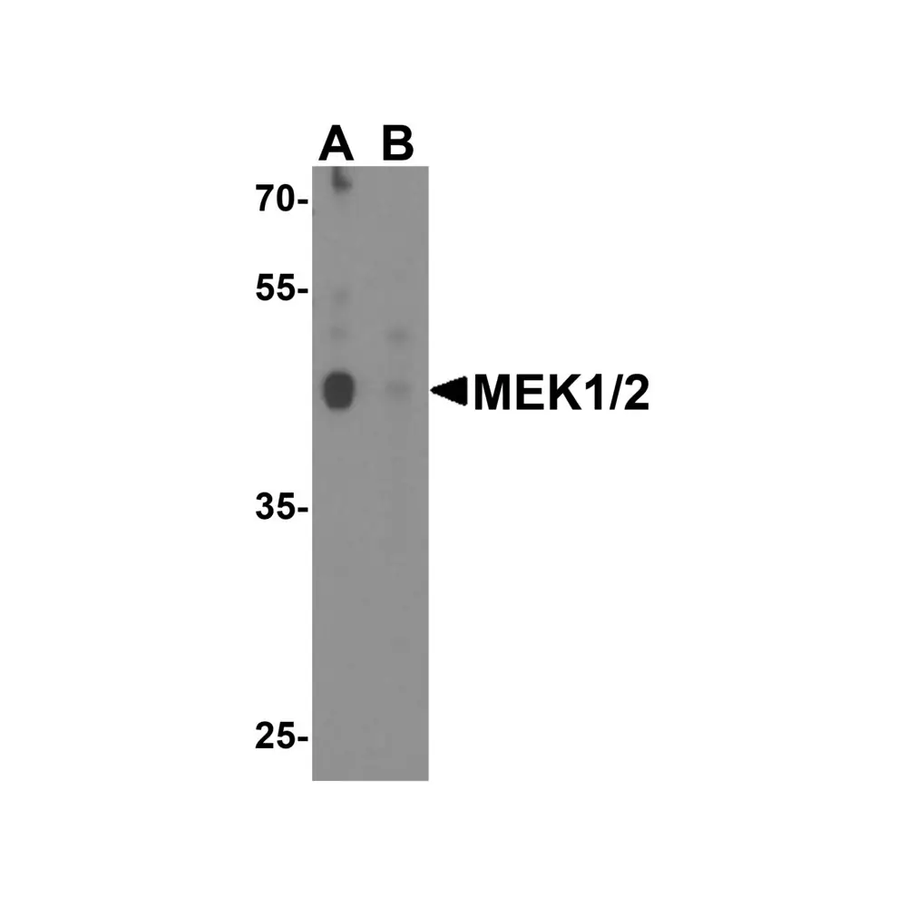 ProSci 8207 MEK1/2 Antibody, ProSci, 0.1 mg/Unit Primary Image