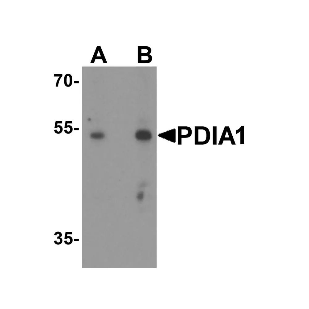 ProSci 8213 PDIA1 Antibody, ProSci, 0.1 mg/Unit Primary Image