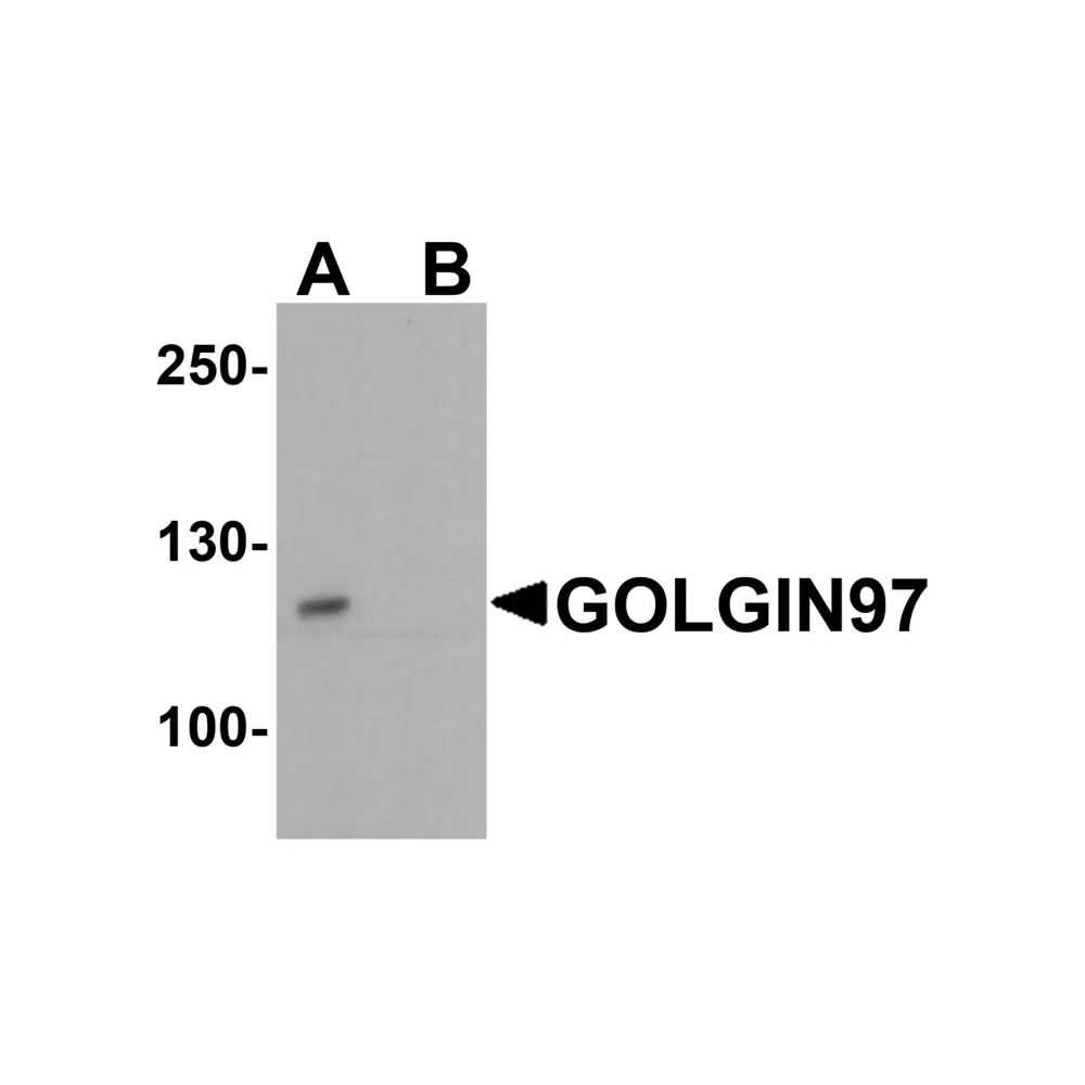 ProSci 8215 GOLGIN97 Antibody, ProSci, 0.1 mg/Unit Primary Image