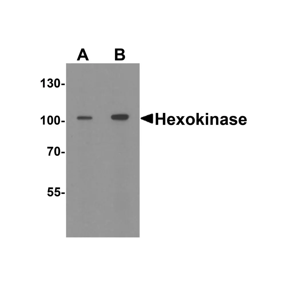 ProSci 8217_S Hexokinase 1 Antibody, ProSci, 0.02 mg/Unit Primary Image