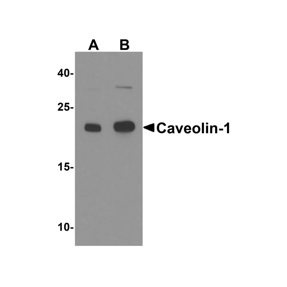 ProSci 8219 Caveolin-1 Antibody, ProSci, 0.1 mg/Unit Primary Image