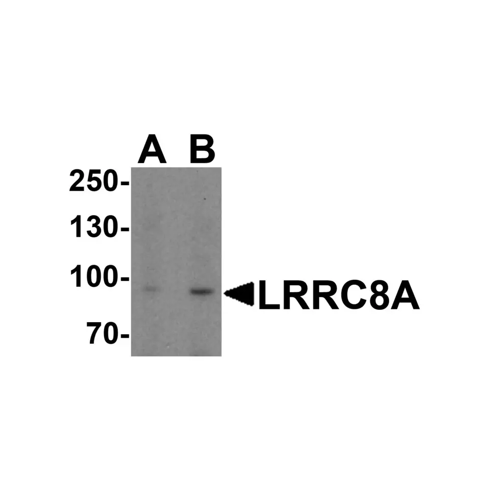 ProSci 8235 LRRC8A Antibody, ProSci, 0.1 mg/Unit Primary Image
