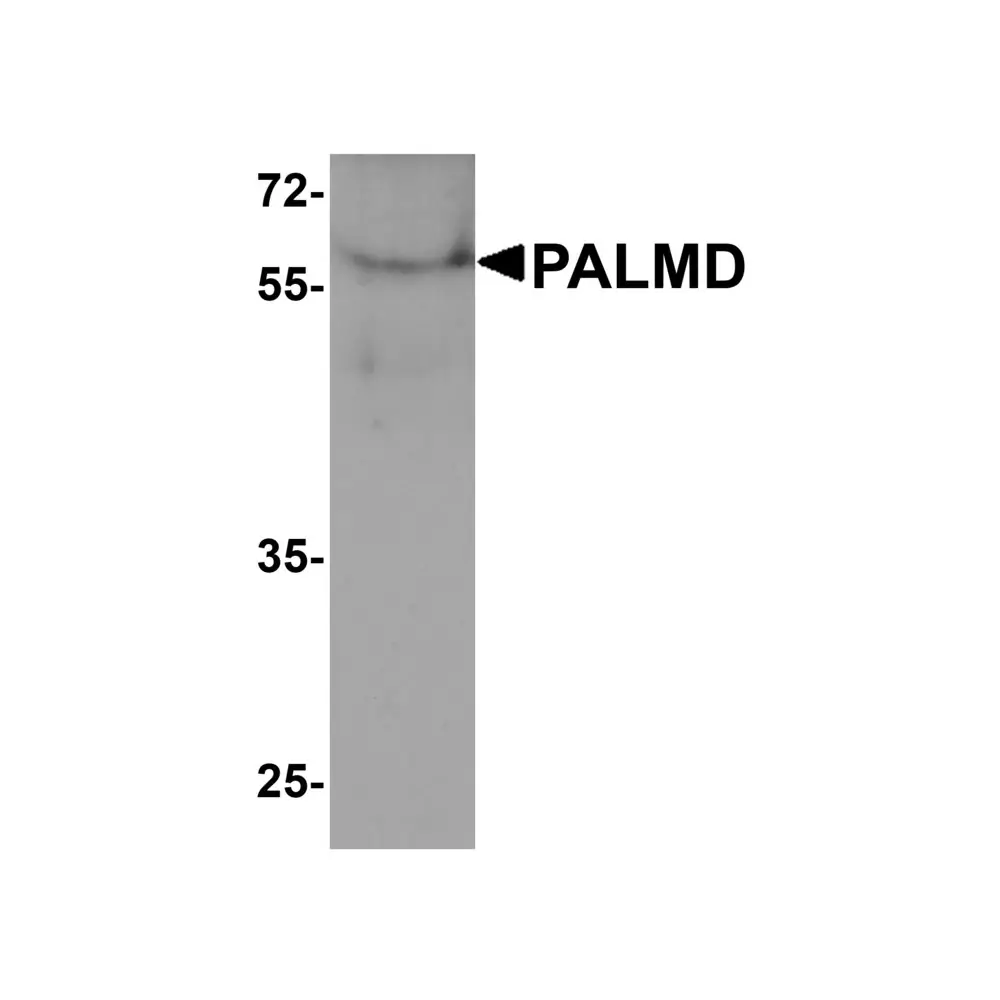 ProSci 8237 PALMD Antibody, ProSci, 0.1 mg/Unit Primary Image