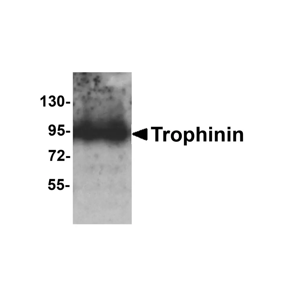 ProSci 8245 Trophinin Antibody, ProSci, 0.1 mg/Unit Primary Image