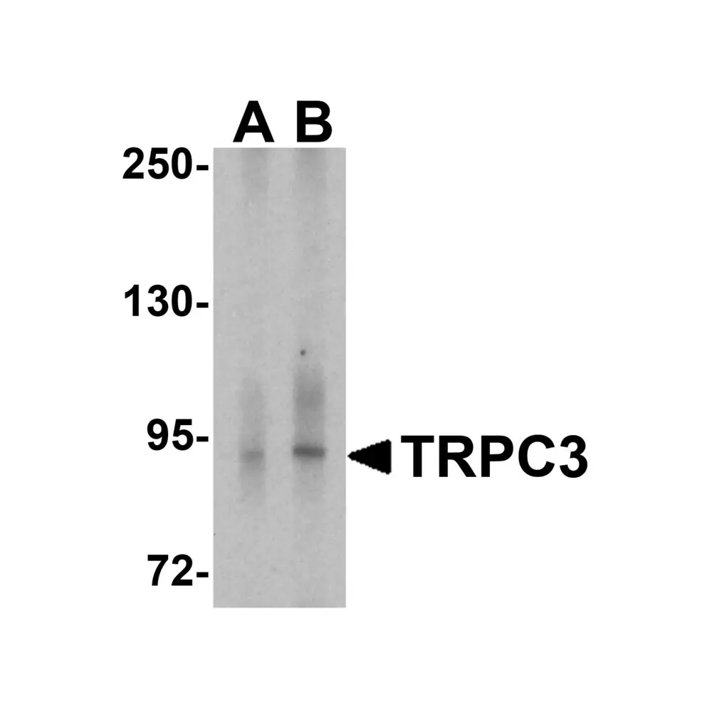 ProSci 8269 TRPC3 Antibody, ProSci, 0.1 mg/Unit Primary Image